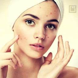 logo for Skin and Face Care - acne, fairness, wrinkles