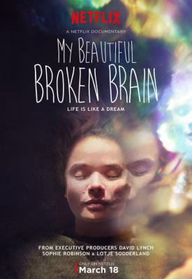 image for  My Beautiful Broken Brain movie